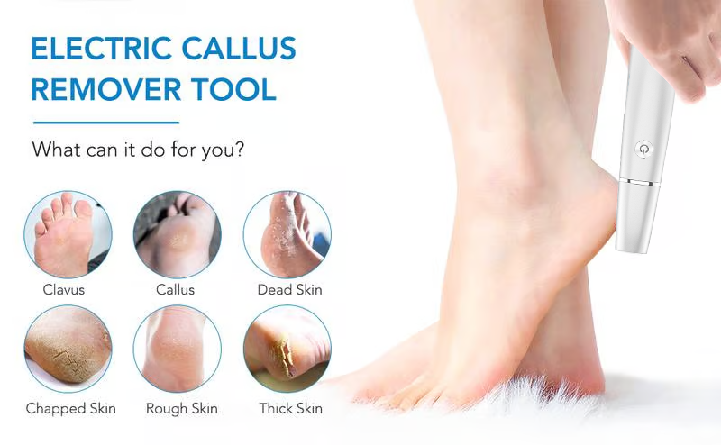 Electric callus remover wand used on hard skin on the heel