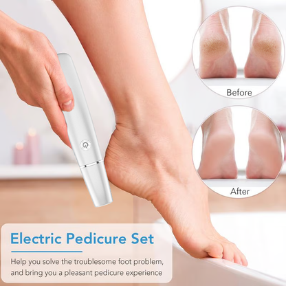 White pen style electric callus remover being used on a heel