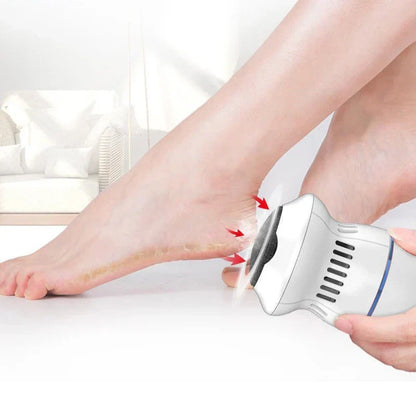 White electric foot file with vented body and rotating sanding disc